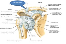 Nội soi khớp vai tái tạo dây chằng quạ - đòn 2 bó 