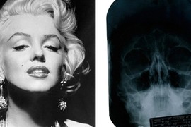 Lộ bằng chứng Marilyn Monroe phẫu thuật thẩm mỹ