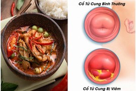 5 thực phẩm "nuôi" khối u xơ tử cung lớn mỗi ngày, cần tránh xa