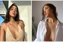 Hot girl liên tục “bỏ quên” nội y, mặc buông lơi gây phản cảm