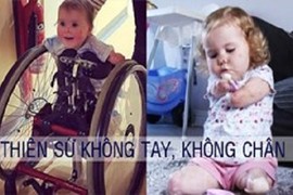 Thiên sứ “không chân tay” khiến cả thế giới không thể không yêu