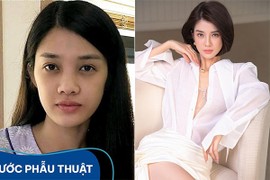 Trình Mỹ Duyên “lột xác” sau phẫu thuật thẩm mỹ