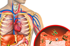 Các dấu hiệu nội tạng đang chứa lượng "rác" quá lớn, cần thanh lọc ngay