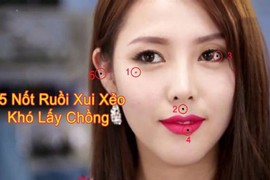 Video: Những nốt ruồi “ám quẻ” nên xóa nếu không muốn gánh họa cả đời