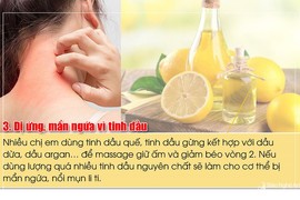 3 sai lầm khi dùng tinh dầu giữ ấm cơ thể trong mùa Đông