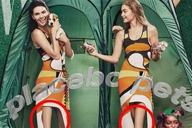 Kendall Jenner mất đầu gối vì photoshop