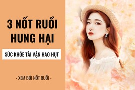 3 nốt ruồi vô cùng nguy hại cho sức khỏe, tuyệt đối không nên giữ