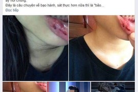 Vụ 'MC truyền hình bị tố bạo hành em vợ': Cơ quan chức năng vào cuộc