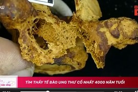 Video: Tìm thấy tế bào ung thư cổ nhất 4000 năm tuổi