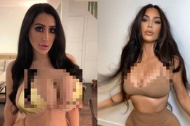 Cô gái trải qua chục lần "dao kéo" để giống Kim Kardashian