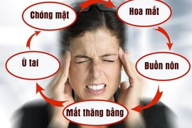 Bác sĩ chỉ cách điều trị rối loạn tiền đình