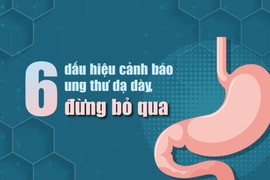 6 dấu hiệu cảnh báo ung thư dạ dày