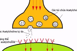 Bệnh nhược cơ là gì, có phải là không thể chữa được?