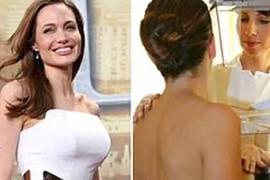 Angelina Jolie làm dấy lên phong trào cắt ngực phòng ung thư