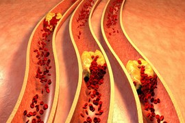 Những sự thật về cholesterol không phải ai cũng biết