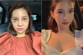 Lưu Đê Ly ngày càng chuộng gu thời trang sexy sau khi “đập mặt xây lại“