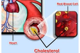 Kẻ thù âm thầm đang giết chết nhiều người trẻ tuổi