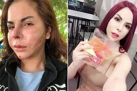 Bị tố câu like hỏng mặt, “hot girl chuyển giới” Linda nói gì?