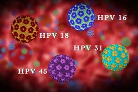 Cách ngăn ngừa virus HPV gây ung thư, mụn cóc sinh dục