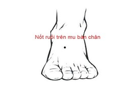 Nốt ruồi trên bàn chân nói lên điều gì? 