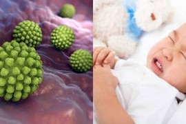 Virus Rota tấn công trẻ em toàn thế giới: BS chỉ ra 8 triệu chứng