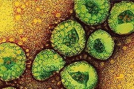 Virus “tử thần” MERS-CoV nguy hiểm như thế nào?