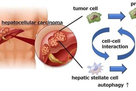 Tìm ra phương thức mới để ngăn ngừa ung thư gan