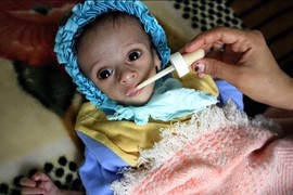 Tháng Ramadan ở Yemen: Nhịn ăn ban ngày, đói khát ban đêm