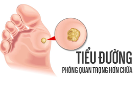 Video: Mắc bệnh tiểu đường từ những nguyên nhân ít ai ngờ