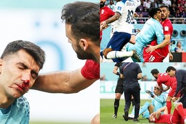 Cận cảnh pha chấn thương kinh hoàng thủ môn Iran tại World Cup 2022