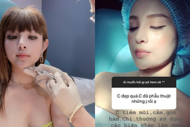 Bị chê "mặt nhựa" do tiêm botox, Huyền Baby phản ứng cực căng