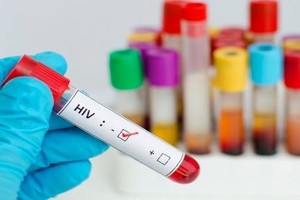 Cưỡng dâm truyền bệnh HIV, xử phạt ra sao?