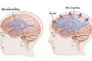 Cha mẹ quyết phẫu thuật cho con dù bác sĩ lắc đầu