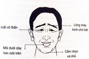 Đàn ông có 1 trong 3 nét tướng này đen đủi đủ đường