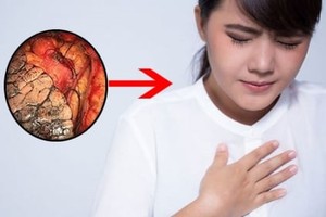 Cơ thể xuất hiện "3 nhanh 2 nhỏ" cảnh báo tuổi thọ đang bị rút ngắn