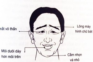 Người sở hữu 2 thứ mỏng, 2 vị trí nhỏ đen cả tình lẫn tiền