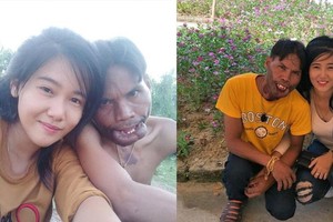 Cuộc hôn nhân không như mơ của chàng trai "mặt quỷ" và "'vợ tiên"