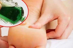 Nhỏ 1 giọt dầu gió vào bàn chân rồi đi ngủ giúp tăng sức khỏe