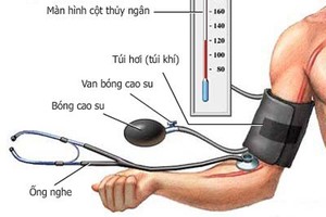 Nguyên do gây huyết áp lúc tăng lúc giảm 