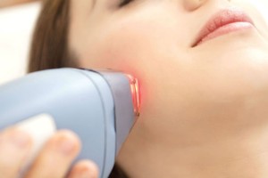 Những ưu điểm tuyệt vời khi tẩy lông bằng tia laser