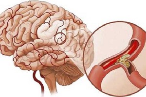 Làm việc đại kỵ này, gái trẻ suýt gục chết trong phòng tắm