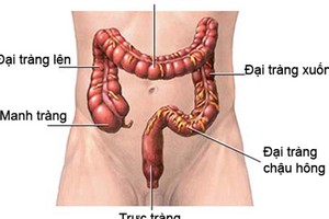 Cách giúp bạn ngừa ung thư đại tràng hiệu quả