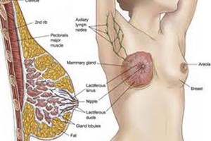 Phân loại các dạng ung thư vú thường gặp