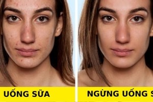 Điều gì xảy ra với cơ thể nếu bạn ngừng uống sữa?