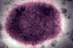 Bùng phát virus hiếm gặp và bất thường tại Anh