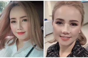 Hoàng Yến khoe nhan sắc xinh đẹp sau ồn ào bị chồng cũ đánh