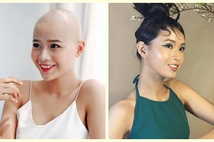 Chân dung 10X chiến thắng ung thư dự thi Miss World Vietnam 2022