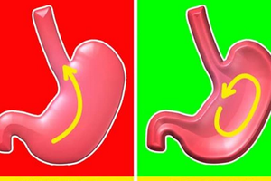 10 lợi ích cho cơ thể khi ngủ bằng gối nằm nghiêng