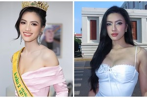 Á hậu Minh Nhàn thay đổi ngỡ ngàng sau khi “đại tu” vòng một