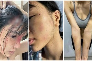 Công an vào cuộc vụ siêu mẫu Khả Trang tố chồng hành hung